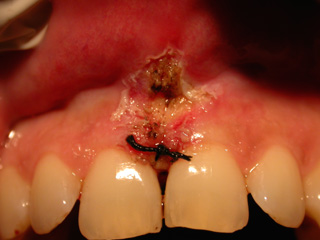 Foto scattata al termine del trattamento tramite laser